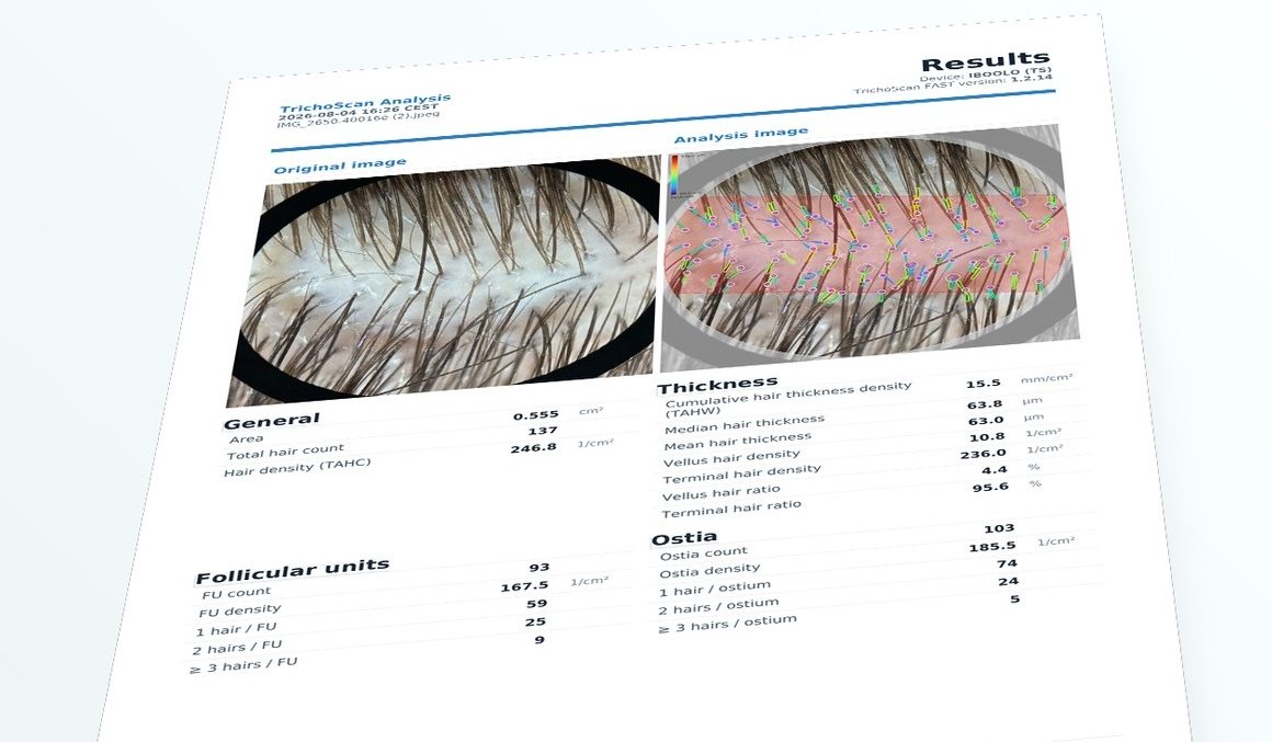 Example TrichoScan FAST result view